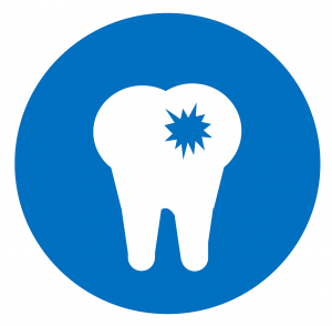 Mason Dentistry - Tooth Decay